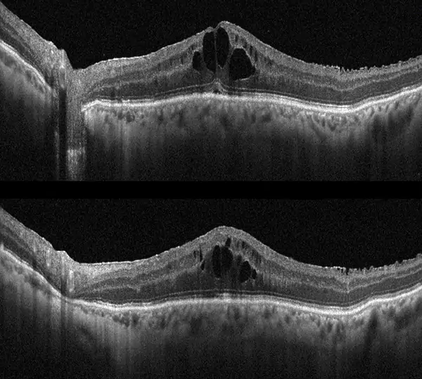 oct macula diagnostica dottor parisio